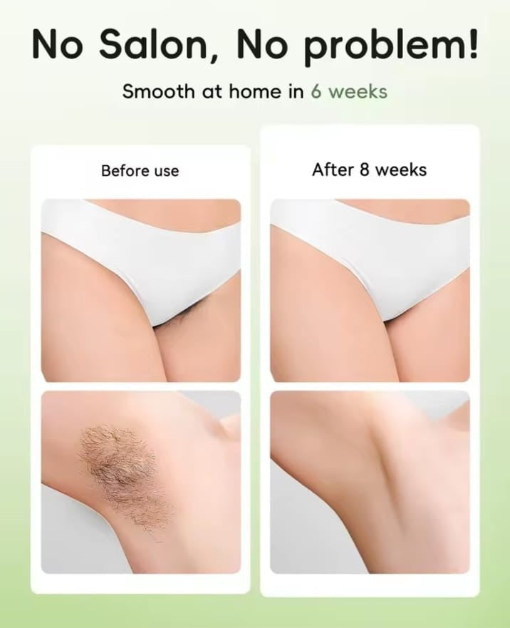 🌙 LUNA™ IPL Hair Removal (Men Pro)